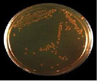 Hektoen Enteric Agar