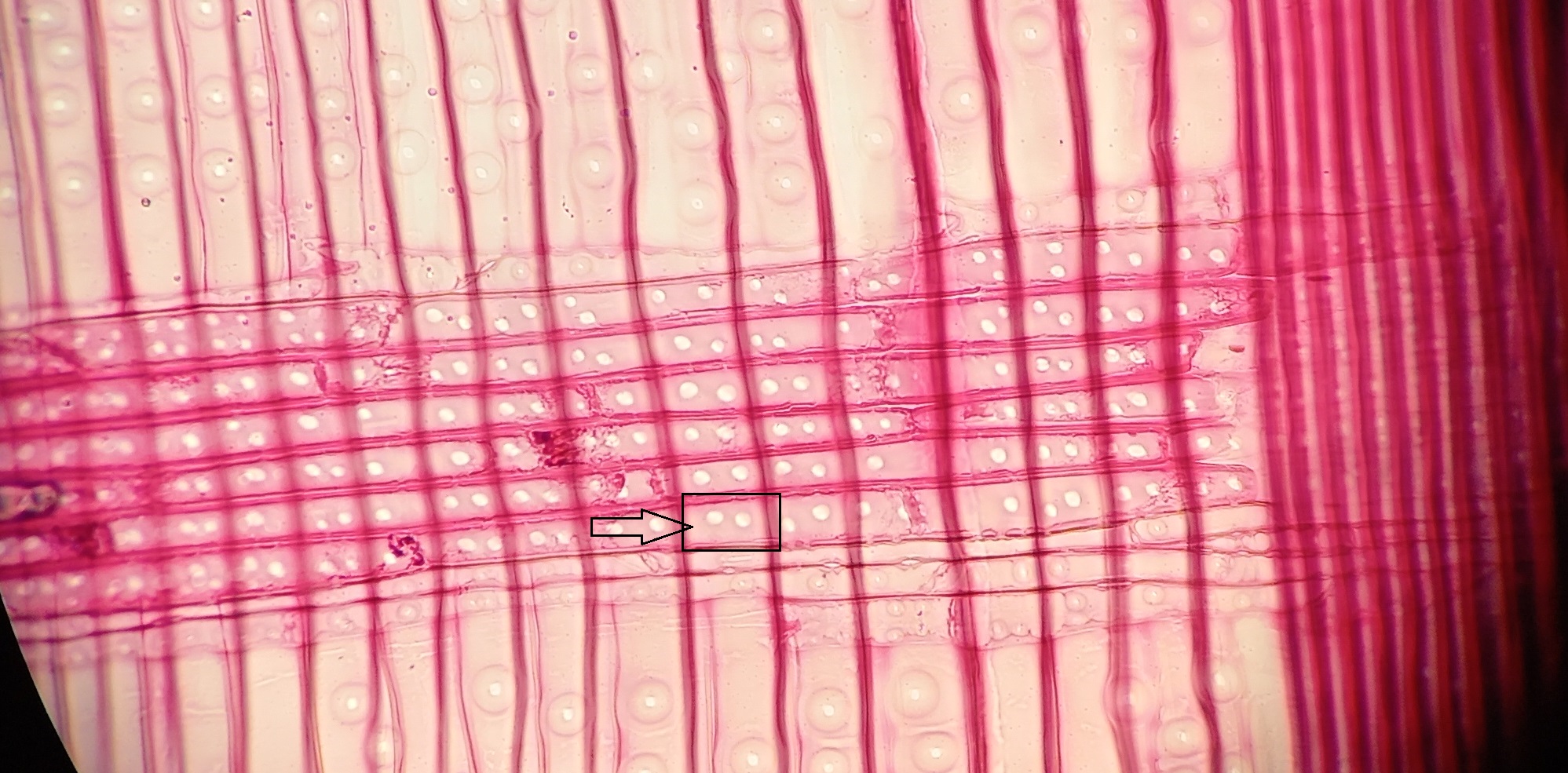 Anatomi kayu Anatomi kayu