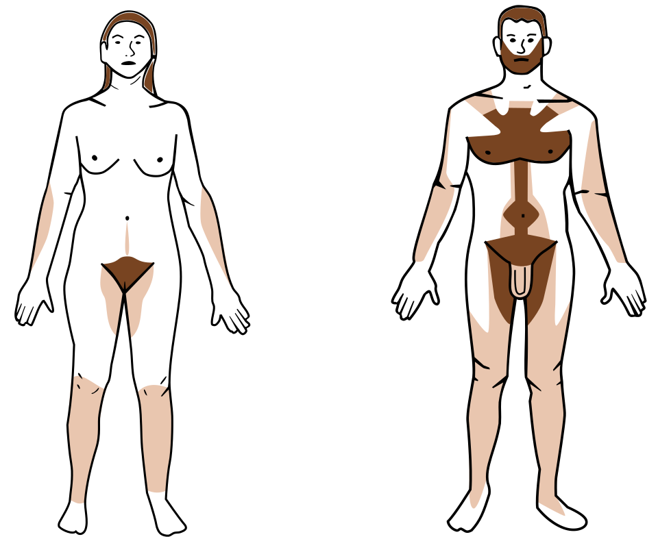 Rambut tubuh Rambut tubuh