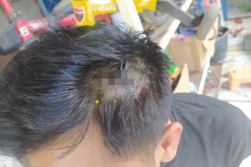 Caddy Golf Dianiaya di Tangerang, Polisi: Korban Alami Luka Robek di Kepala