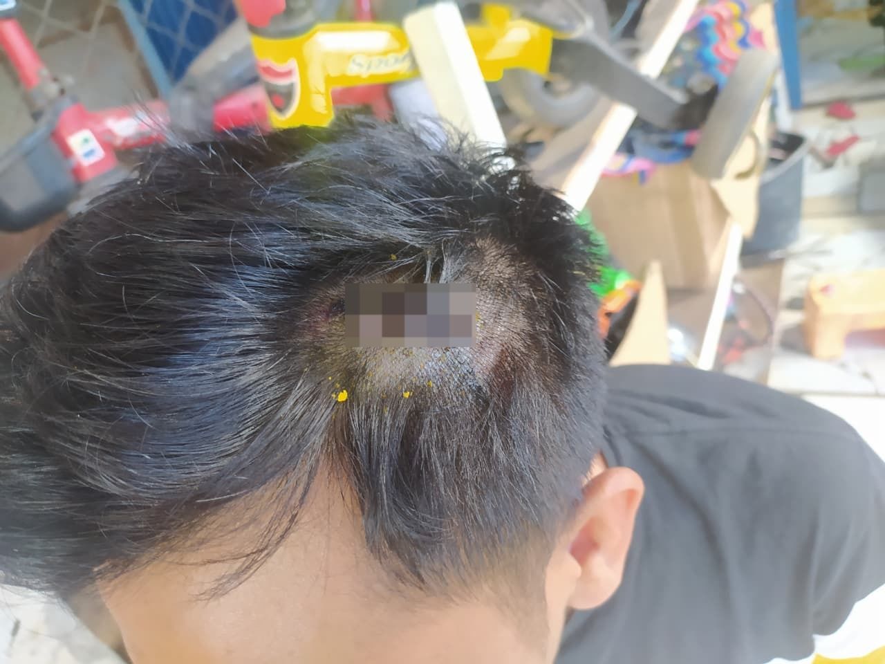 Caddy Golf Dianiaya di Tangerang, Polisi: Korban Alami Luka Robek di Kepala
