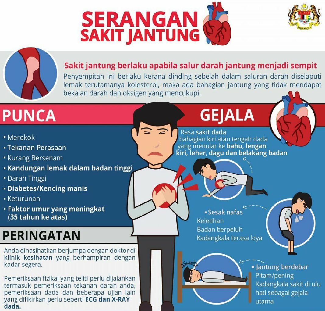Sakit Jantung, Tio Pakusadewo Tak Bisa Jalan, Tetap Merokok dan Ngopi dari Kursi Roda