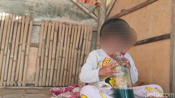 Derita Bocah Disabilitas Yatim Piatu di Sukabumi, Kecanduan Hirup Bensin di Tengah Keterbatasan, Menanti Uluran Tangan