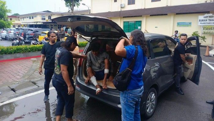 Bikin Konten Seolah Jadi Korban Begal Hingga Jari Tangan Putus, Bayu Jadi Berurusan dengan Polisi